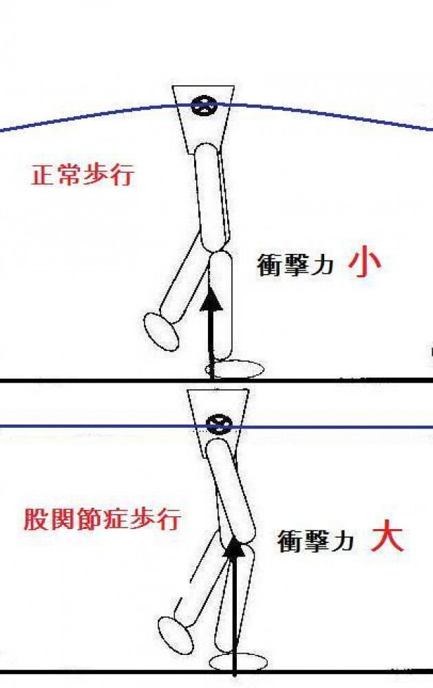 衝撃吸収