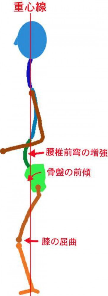 仰向けで膝が伸びない