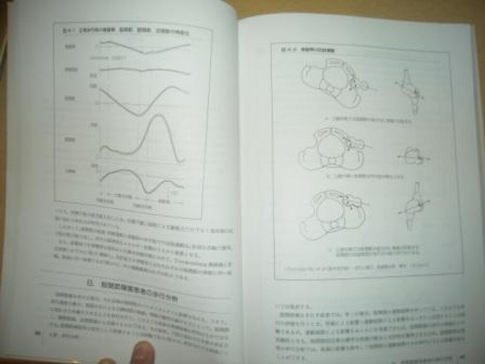 歩行分析