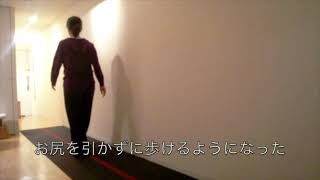 [施術事例] 30代 臼蓋形成不全 引越し