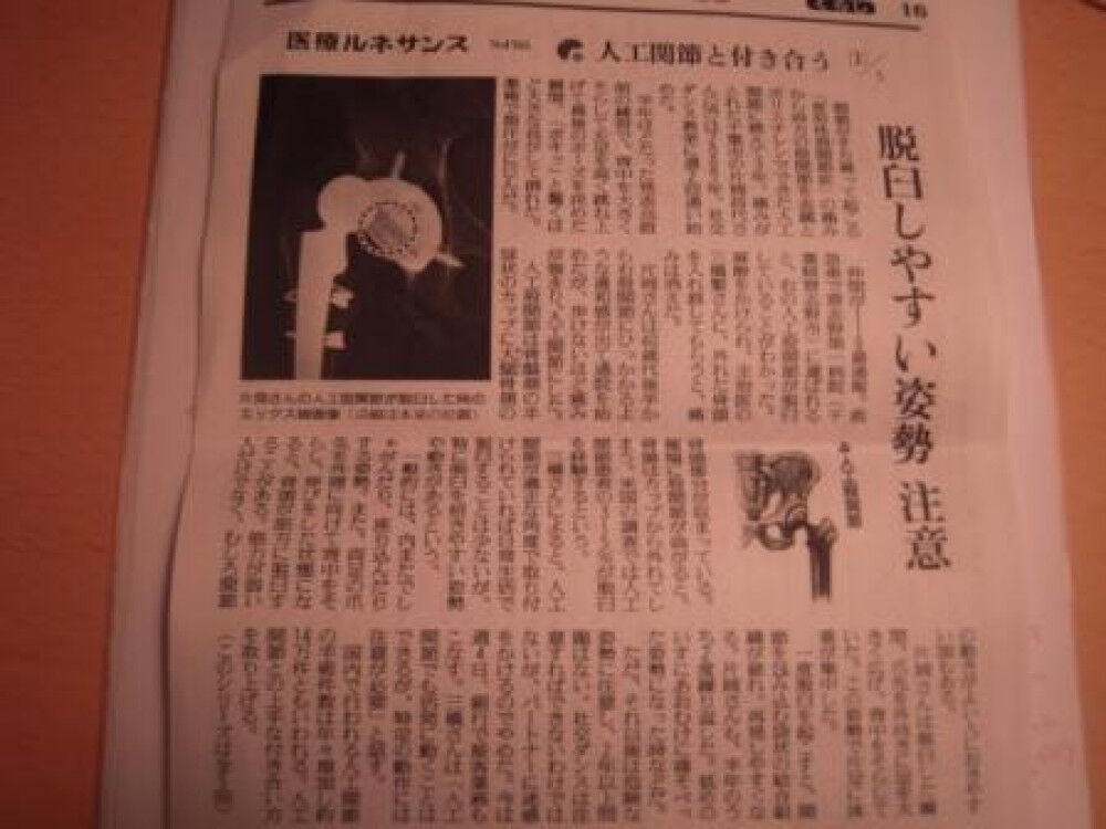 姿勢と脱臼の関係