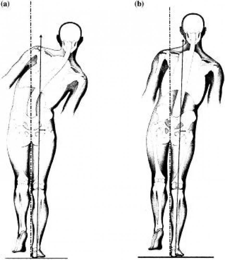[研究論文] 歩き方への介入 EBM