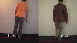 [施術事例] 70代 変形性股関節症 末期