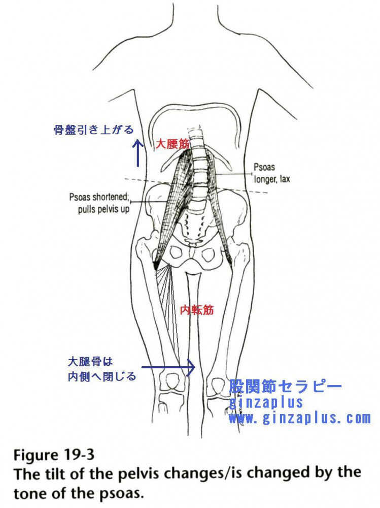[脚長差の前触れ] 姿勢や歩き方における注意点
