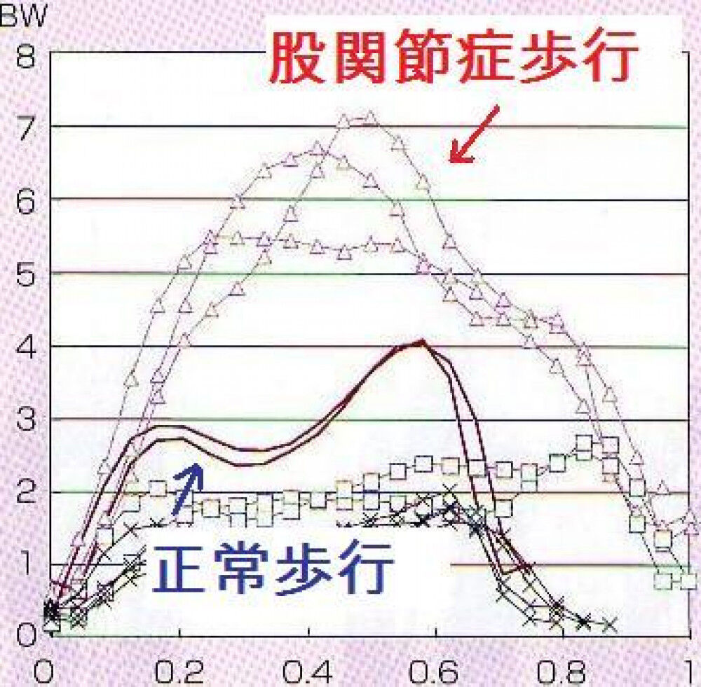 [研究論文] 正しい歩き方が必要な理由