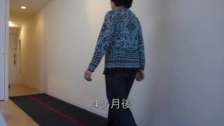 [施術事例] 70代 骨切り術(RAO)後 人工股関節