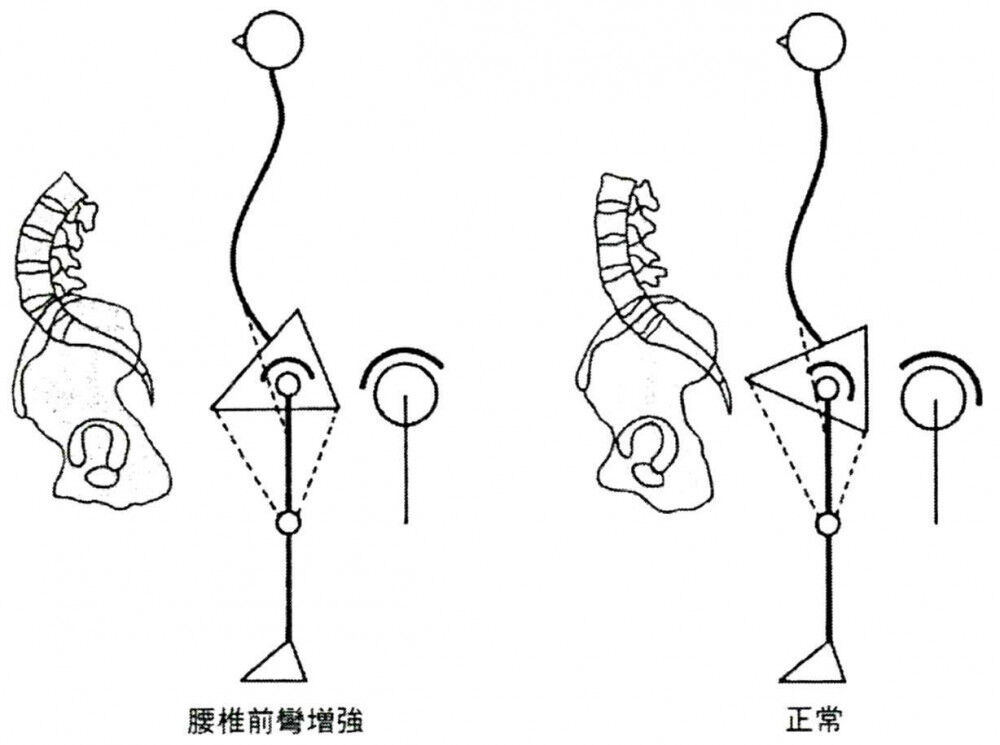[研究論文] 中殿筋の働きは姿勢で変わる