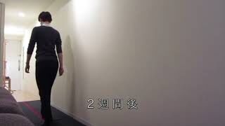 [施術事例] 40代 変形性股関節症 末期 外股歩き