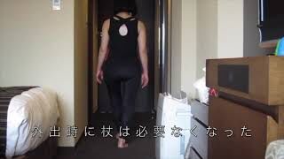 [施術事例] 60代 先天性股関節脱臼 保存療法一筋32年