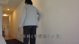 [施術事例] 40代 人工股関節手術後 痛み