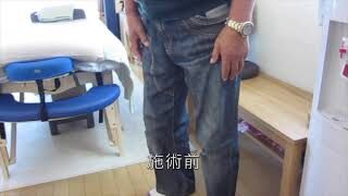 [施術事例] 60代 大腿骨頭壊死症 手術前リハビリ