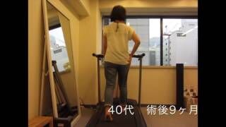 股関節唇損傷 股関節鏡視下手術後の歩容の変化