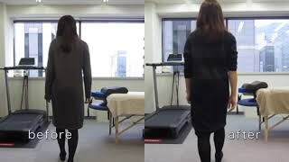[施術事例] 30代 股関節唇損傷 開脚ストレッチ