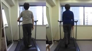 [施術事例] 70代 変形性股関節症 末期