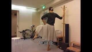 [施術事例] 20代 股関節唇損傷 プロダンサー