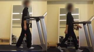 [施術事例] 60代 股関節唇損傷 ゴルフ