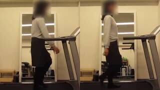 [施術事例] 30代 変形性股関節症 初期 骨切り術を勧められて