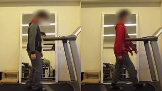 [施術事例] 10代 臼蓋形成不全 転倒傾向