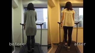 [施術事例] 20代 大腿骨頭壊死症 ステロイド