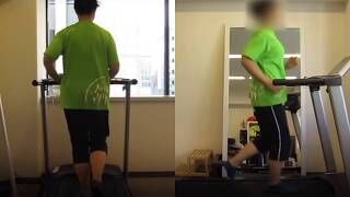 [施術事例] 40代 臼蓋形成不全 ウルトラマラソン
