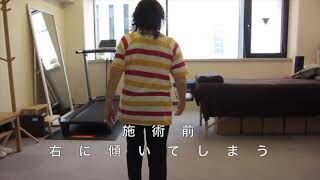 [施術事例] 60代 変形性股関節症 末期