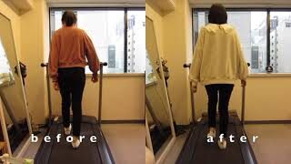 [施術事例] 20代 骨切り後 新入社員