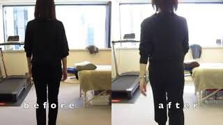 [施術事例] 40代 股関節唇損傷 怖さ