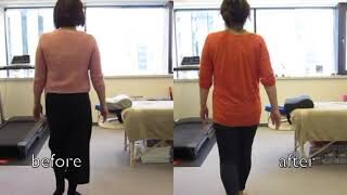 [施術事例] 50代 変形性股関節症 手術前リハビリ