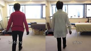 [施術事例] 80代 変形性股関節症 末期