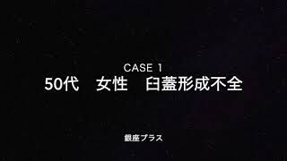 【変形性股関節症】保存療法のリスク１