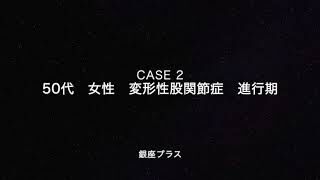 【変形性股関節症】保存療法のリスク2