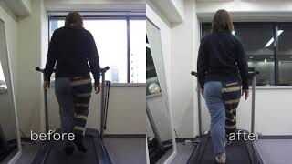[施術事例] 40代 股関節唇損傷