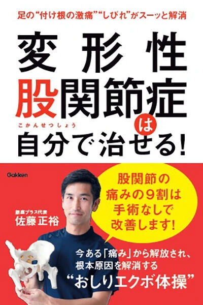 変形性股関節症